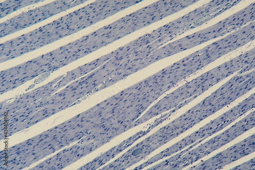 Human cardiac muscle under the microscope