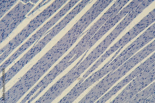 Принти на полотні Human cardiac muscle under the microscope