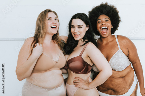 Diverse women embracing their natural bodies photo