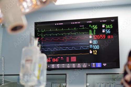 The screen showed monitoring vital sign during open heart surgery.