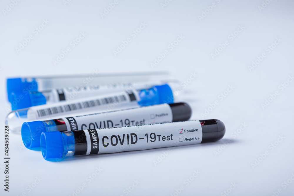 Fototapeta premium Test tube with blood sample for COVID-19 test