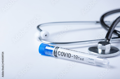 Test tube with blood sample for COVID-19 test