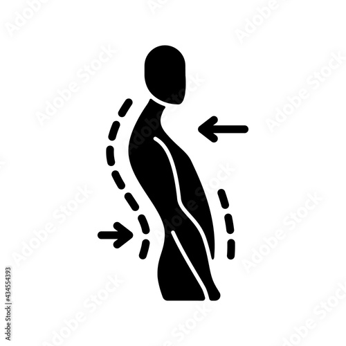 Swayback posture black glyph icon. Spine curvature disorder. Poor posture. Postural deformity. Backward thoracic spine movement. Silhouette symbol on white space. Vector isolated illustration