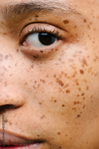 Fototapeta Close up portrait of girl with freckles