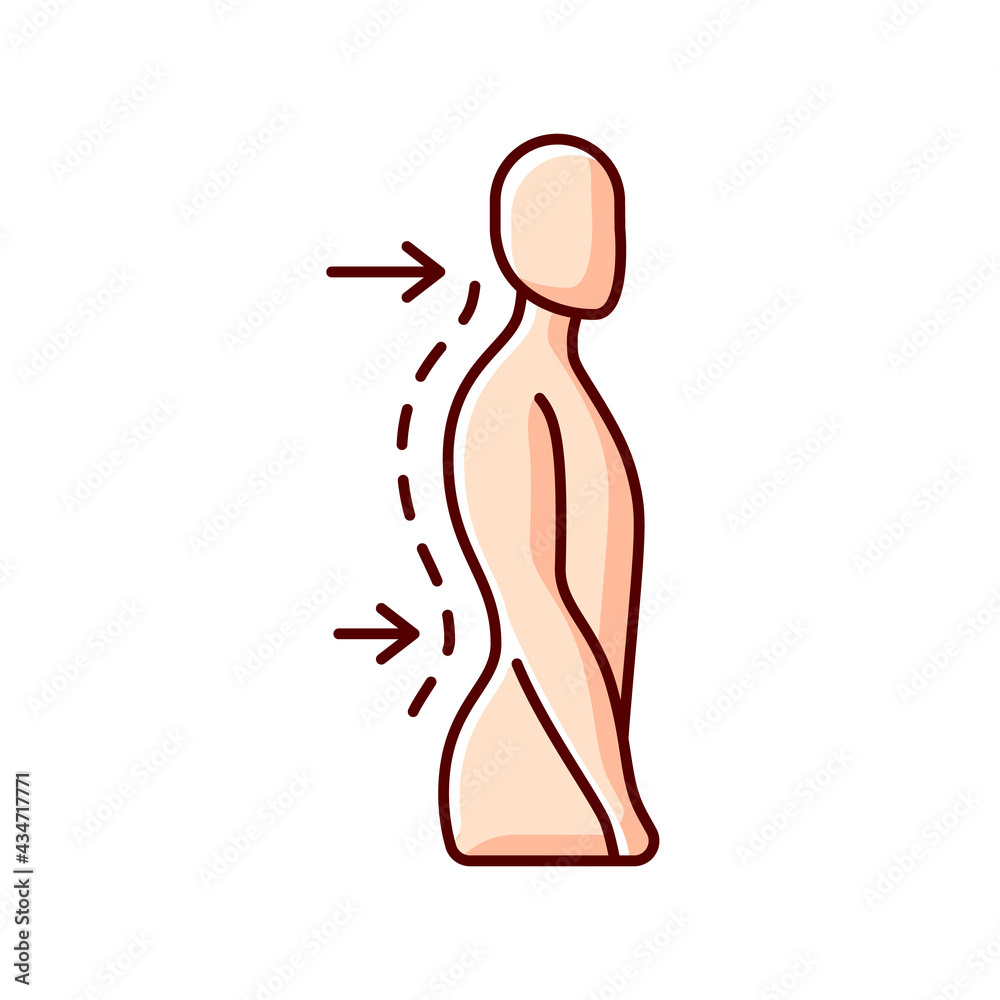 Lumbar lordosis RGB color icon. Excessive inward spine curve. Saddleback appearance. Difficulty with coordination. Exaggerated posture. Abnormal development. Isolated vector illustration