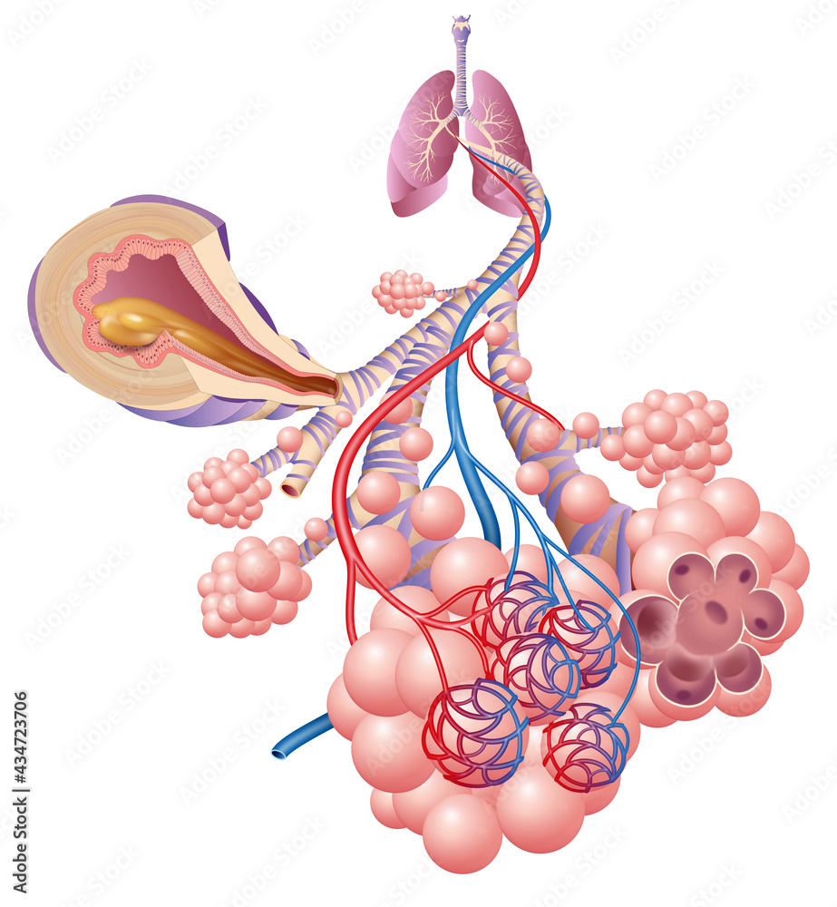 Illustration showing the inflamation of the bronchus causing asthma - obrazy, fototapety, plakaty 