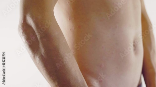 homme, psoriasis, eczéma, problème de peau, médicale, corps, femme, nu, sein, beauté, jeune, beau, peau, torse, poitrine, santé, blanc, modèle, fitness, musculaire, mince, isolé, sain, arrière, main, 