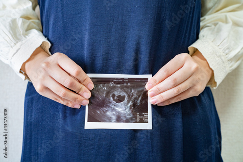 赤ちゃんのエコー写真を持った妊婦の写真。妊娠中のイメージ。
