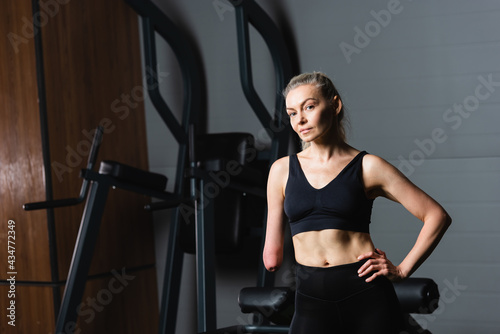 amputee woman in black sportswear standing with hand on hip in gym