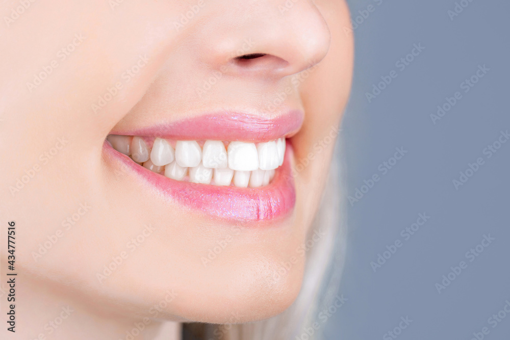 Fototapeta premium Teeth Whitening. Dental health Concept. Teeth whitening procedure. Dental care. Dentistry concept. Perfect healthy teeth. Closeup shot of woman's toothy smile. Perfect healthy teeth smile woman