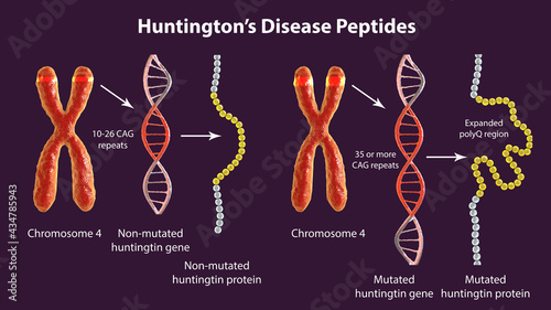 Molecular genesis of Huntington's disease, 3D illustration photo