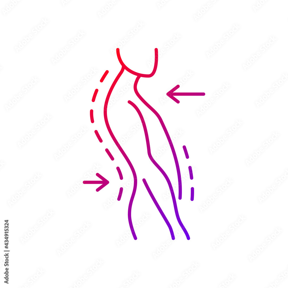 Swayback posture gradient linear vector icon. Spine curvature disorder. Poor posture. Postural deformity. Thin line color symbols. Modern style pictogram. Vector isolated outline drawing