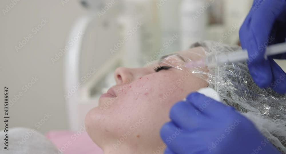 Close-up shot. Skin revitalization and mesotherapy. Female doctor cosmetologist performing surgery biorevitalization injections of a woman face skin.