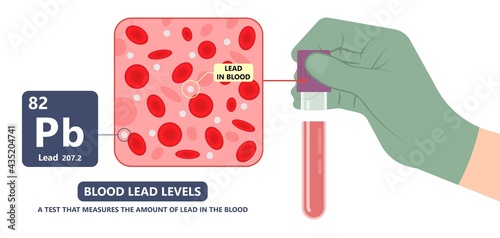 Heavy Metal Lead Iron toxic industry water air food based paint brain cancer kidney health human environmental contamination power plant risk danger fish Drink line test kids level lab poison waste