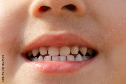 Perfect and aligned teeth of little kid, Perfect and beautiful smile of kid.