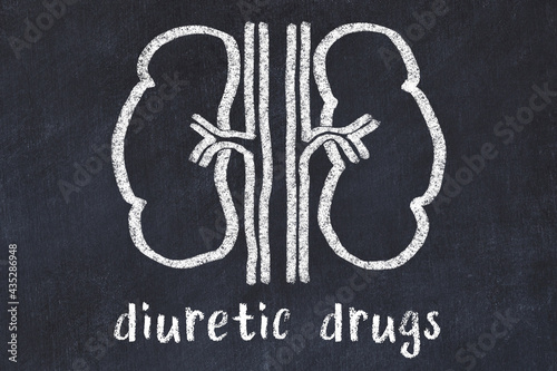 Chalk drawing of human kidneys and medical term diuretic drugs. Concept of learning medicine