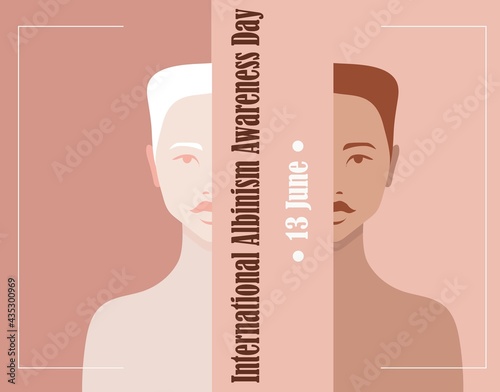 International Albinism Awareness Day, 13 June, Call for Solidarity with People with Albinism in Their Difficulties, People with Albinism and Human Rights, Girl Poster, Stylized Vector Graphics
