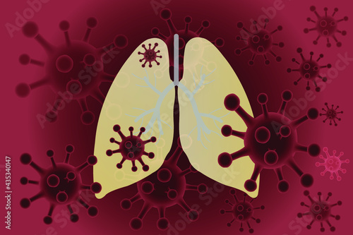 Coronavirus disease COVID-19. Viral epidemics are transmitted by breath, saliva droplets, and exposure. Viral lung infection.