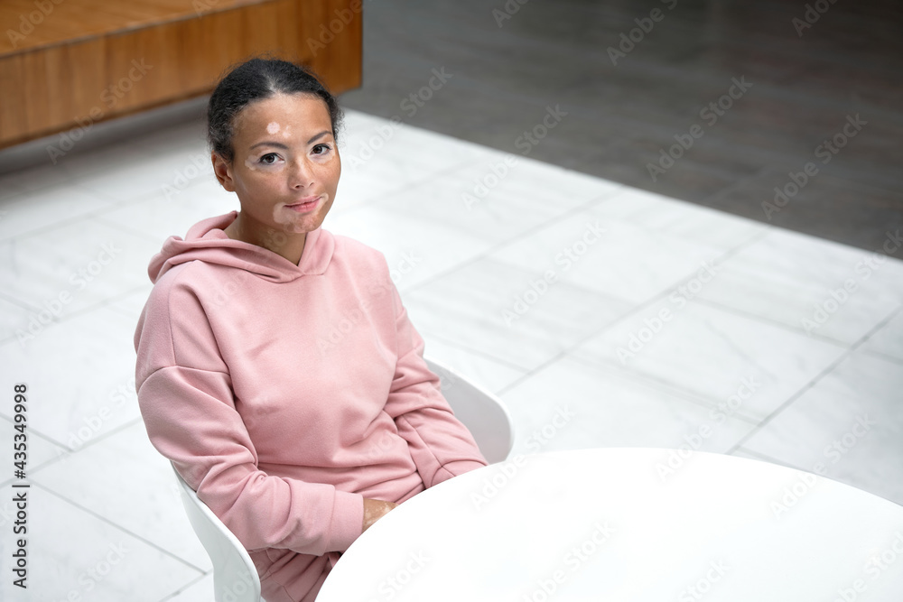 Obraz premium Black african american woman with vitiligo pigmentation skin problem indoor dressed pink hoodie