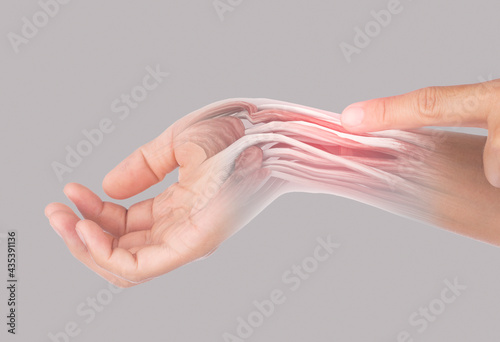 x-ray wrist muscle pain