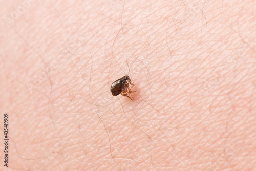 Flea  on human skin. Destruction of parasites in pets photo