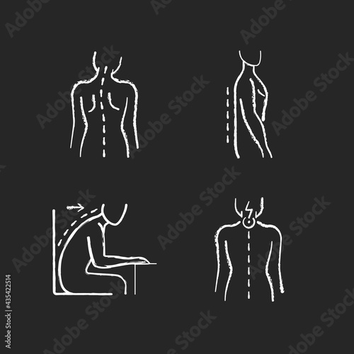Bad posture problems chalk white icons set on black background. Head tilt. Flatback syndrome. Spinal abnormalities. Neck pain. Losing normal curvature. Isolated vector chalkboard illustrations
