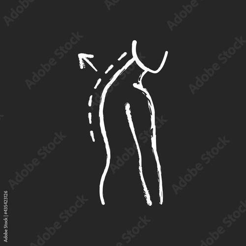 Thoracic kyphosis chalk white icon on black background. Prominent shoulder blade. Spinal disorder. Roundback, hunchback. Increased front-to-back curve. Isolated vector chalkboard illustration