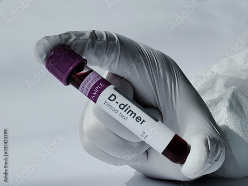 D-dimer blood test