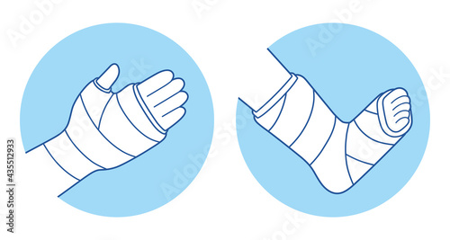 Broken arm and leg, bone fracture, orthopedic plaster cast, trauma rehabilitation icons.