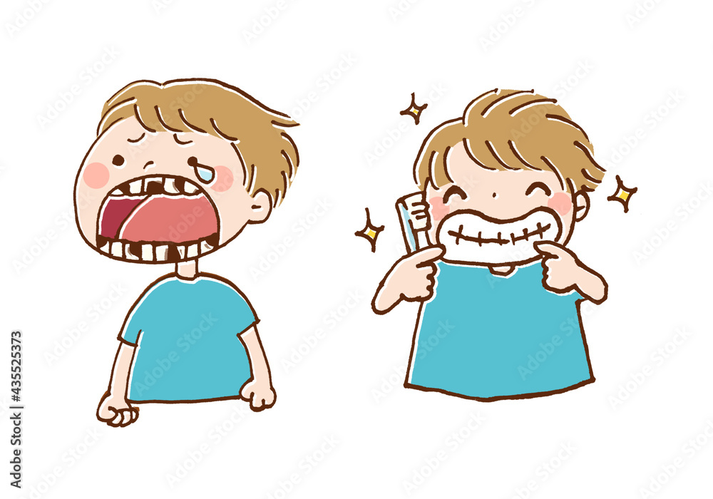 子どもの虫歯と歯磨きのイラスト Stock Illustration Adobe Stock
