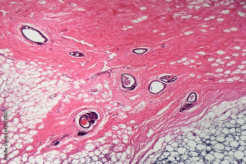 Human mammary gland cells under the microscope photo