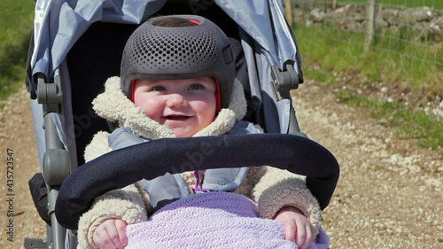 Baby girl wearing a cranial remoulding helmet flat head photo