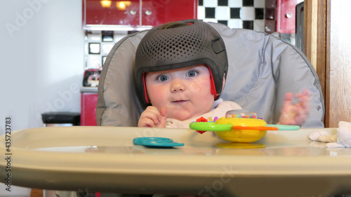 Baby girl wearing a cranial remoulding helmet flat head