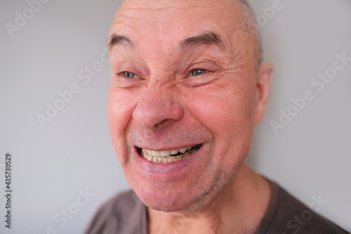 face of a European old man close-up, wrinkles on the aging skin, bares his teeth, makes grimaces, opening his mouth, the concept of mental health, cosmetology, age-related changes