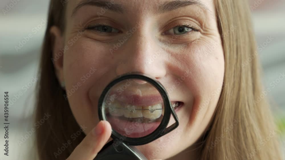 Woman showing her braces in magnifying glass Woman showing her braces in magnifying glass