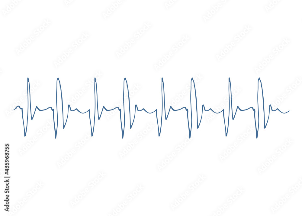Heart disease cardiogram. Heartbeat line. Cardiogram. Electrocardiogram. Ecg line. Heart pulse monitor with signal