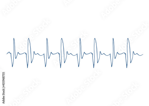 Heart disease cardiogram. Heartbeat line. Cardiogram. Electrocardiogram. Ecg line. Heart pulse monitor with signal