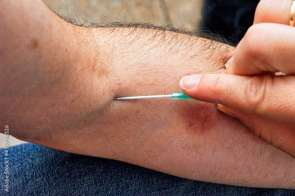 Blood test