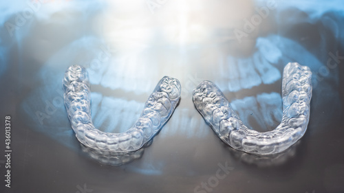 Transparent bite correction trays and x-ray of the jaw. Orthodontist equipment