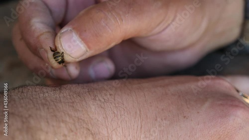 Bee sting in the hand for healing. Medicinal properties of bee venom. photo