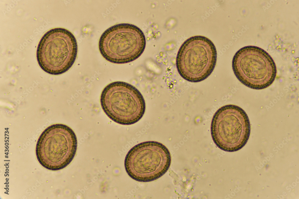 What Do Tapeworm Eggs Look Like In Human Stool - Infoupdate.org