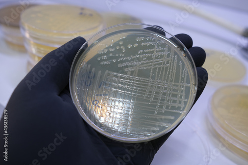 Canvas-taulu growth of bacterial colonies on agar media in a plastic plate