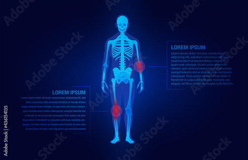 Pain of the elbow and knee joints concept as skeleton. Blue background and red injury man body leg medicine template. Painful Joints.Rheumatism or rheumatic disorder medical.