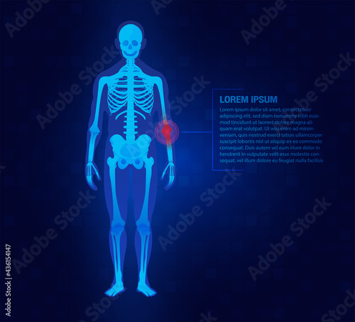 Pain of the elbow joints concept as skeleton. Blue background and red injury man body leg medicine template. Painful Joints.Rheumatism or rheumatic disorder medical.