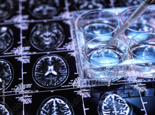 Petri dish on brains can