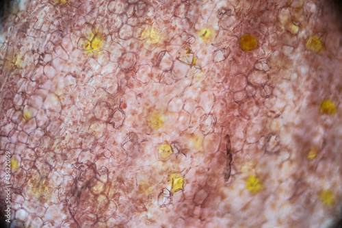 Pickled ginger root under the light microscope, magnification 100 times, microscope objective 10 photo