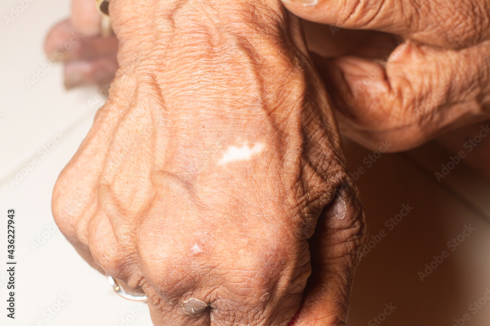 Fototapeta premium The old woman is showing her hand. close up stock photo.old women skin texture.