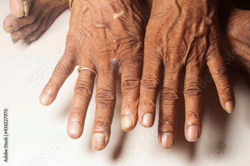 The old woman is showing her hand. close up stock photo.