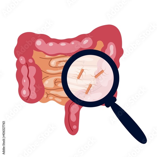 Illustration of salmonella infection in gut