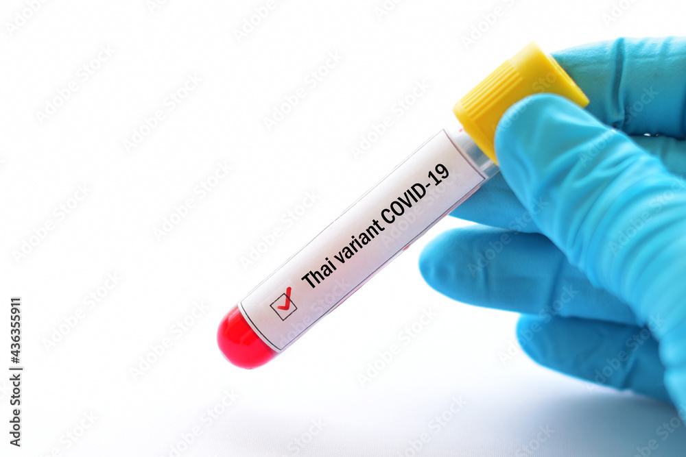 Obraz premium Thai variant of COVID-19, blood sample tube positive with Thai strain of COVID-19 virus 